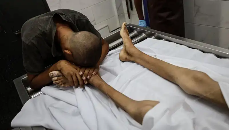 Gazze'de Yaşanan Acı: Bir Çocuk Daha Açlıktan Hayatını Kaybetti