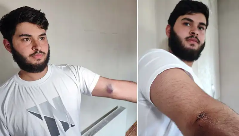 Bahçedeki Top Macerası Mahallede Kargaşaya Yol Açtı