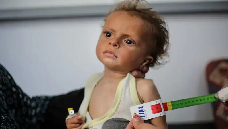 İngiltere, Gazzeli Çocuklar İçin Umut Oluyor: 300 Çocuğa Destek